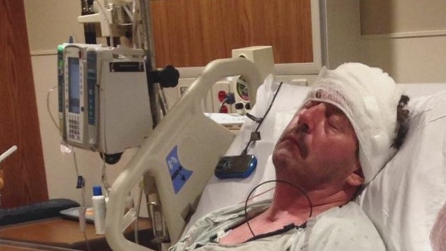 Man nearly killed by drunk neighbor in attack over fallen leaves