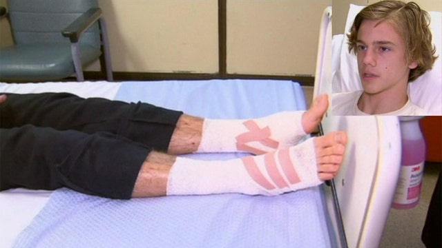 Teen's feet bloodied by mystery sea creatures