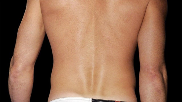 Colorado town retains ban on topless women