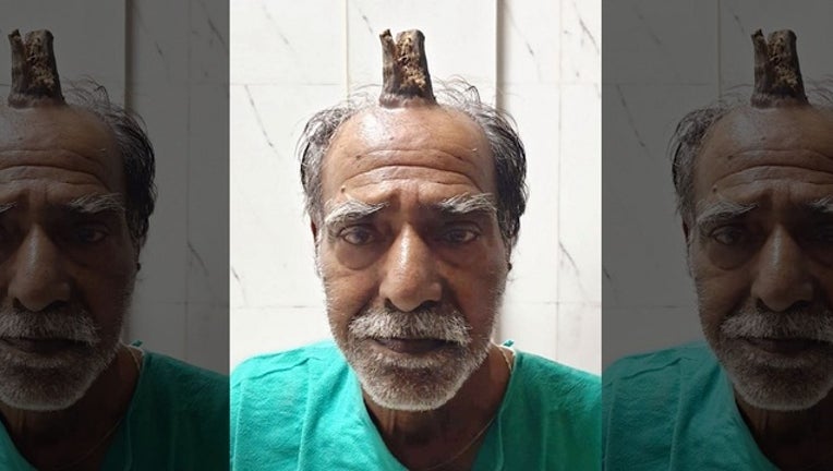 96c3f547-MAN HAS DEVIL HORN REMOVED_1568749282163.jpg-402429.jpg