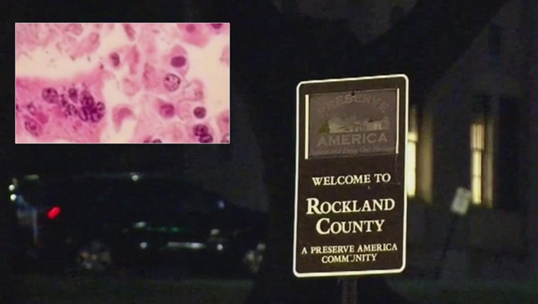 ROCKLAND_MEASLES_032619_1553654440660.jpg