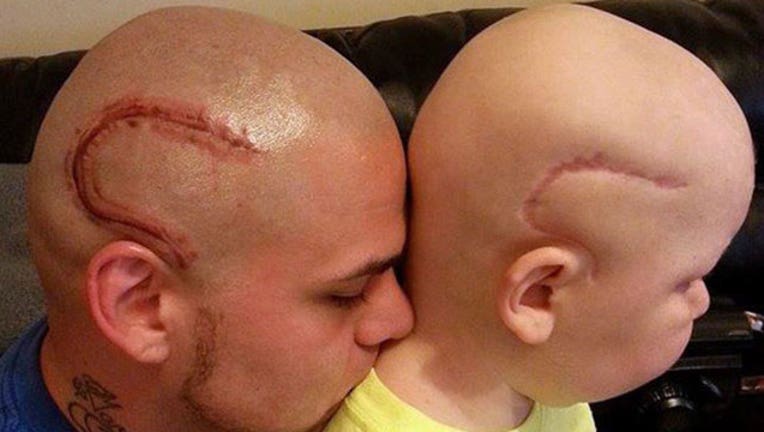 Dad Gets Tattoo to Match Son's Surgery Scar