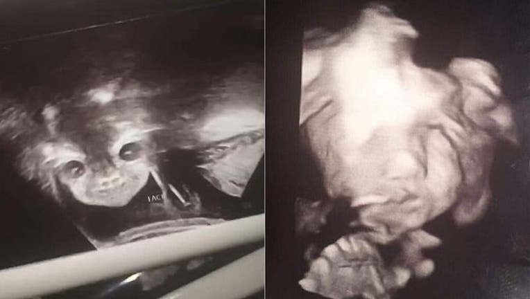 7403d924-baby-scan-2-Kennedy-News_1568305518288-402429.jpg
