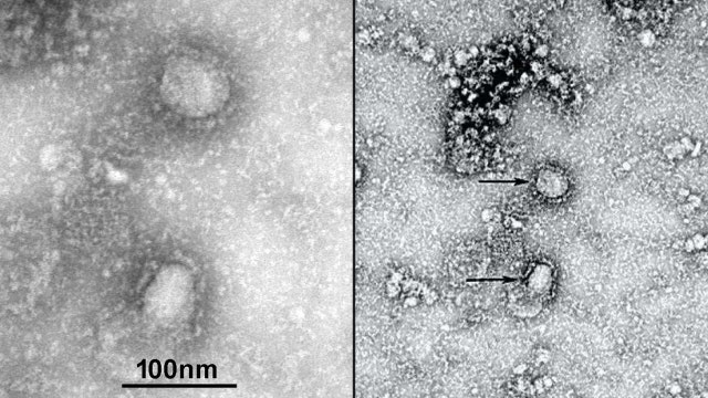 NJ sets up Coronavirus hotline