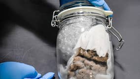 Human brain seized by border protection