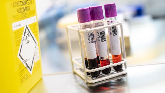 Roughly 3 in 10 Americans believe COVID-19 was created in a lab, survey says