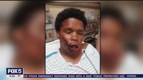 Family says Bronx teen stun-gunned, assaulted by cop