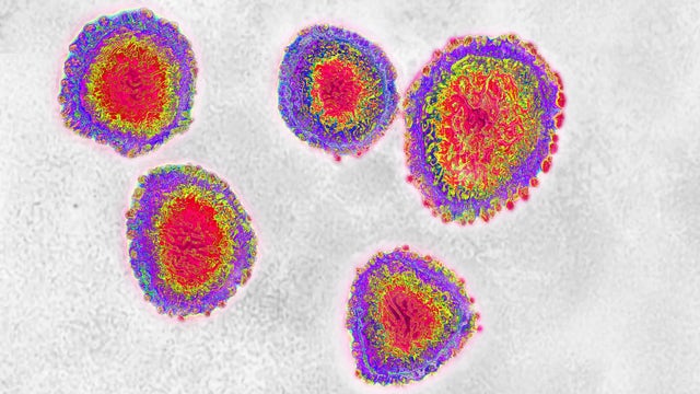 China warns Kazakhstan is facing pneumonia outbreak more deadly than COVID-19