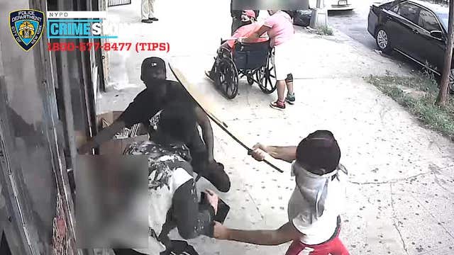 Bronx attack leaves man in critical condition