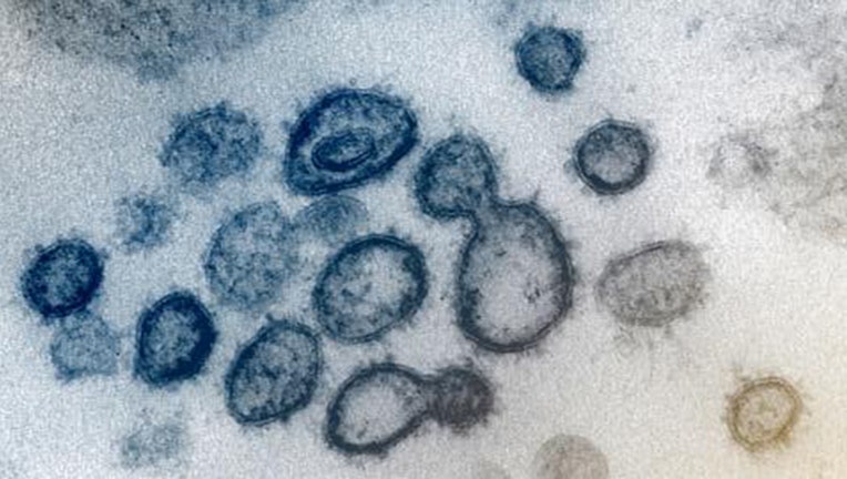 A transmission electron microscope image shows SARS-CoV-2, also known as the 2019 novel coronavirus, which causes CO