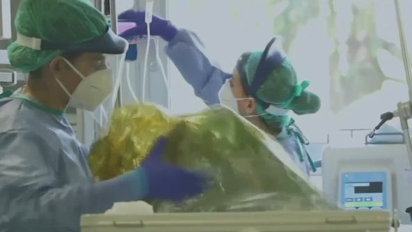 U.S. virus cases rising