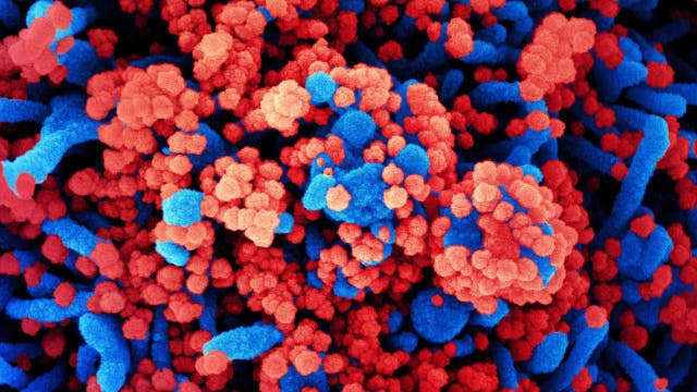 New COVID-19 strains shows possible 'resistance' to antibody, but not vaccines