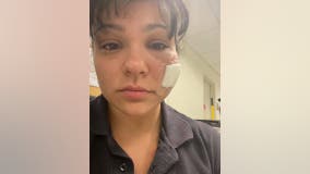 Patient bites FDNY paramedic in the face in Brooklyn