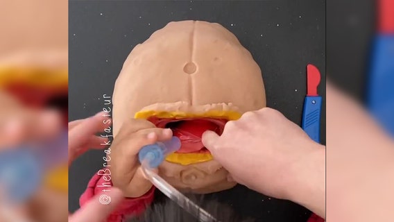 Doctor teaches 4-year-old son how to perform surgeries using play dough