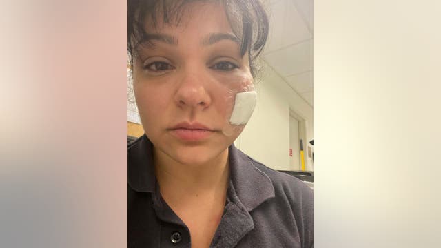 Patient bites FDNY paramedic in the face in Brooklyn