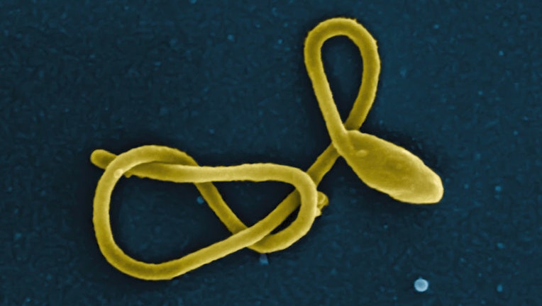 Ebola virus particle