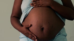 Miscarriage risk 43% higher for Black women, new study suggests