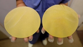 Victims of faulty breast implants must be compensated, court rules