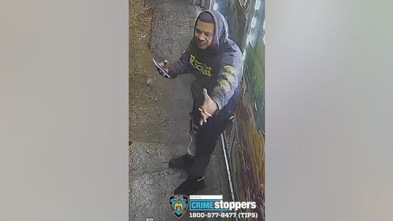 Man loses teeth in unprovoked Bronx attack