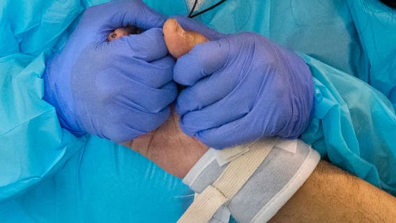 COVID-19 toll in US projected to drop this summer, but variants could set back progress