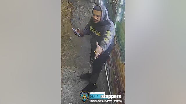 Man loses teeth in unprovoked Bronx attack