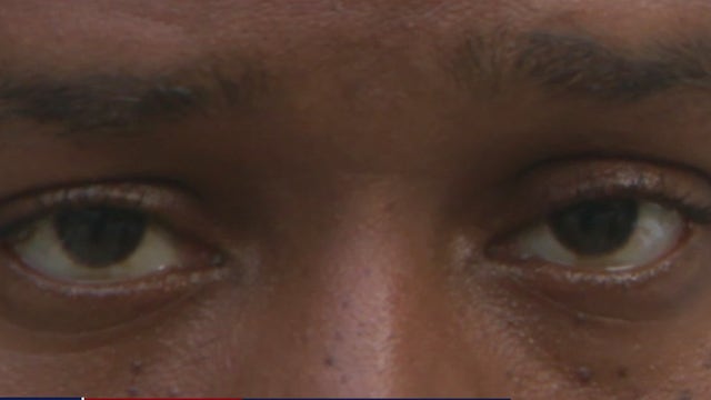 To fight eye strain from too much screen time, 'eye yoga' gains popularity