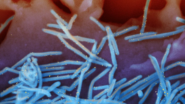 Cold weather virus in summer baffles doctors, worries parents