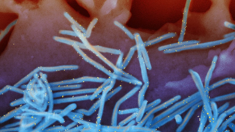 Scanning electron micrograph of RSV. (Photo by: IMAGE POINT FR/NIH/NIAID/BSIP/Universal Images Group via Getty Images)