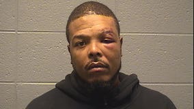 Man beats off-duty Chicago police officer, bites off friend’s nipple in road rage incident: report