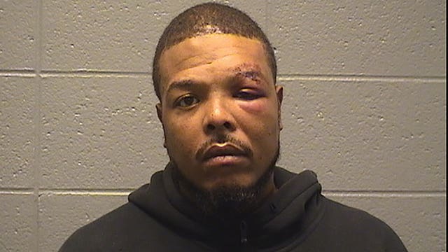 Man beats off-duty Chicago police officer, bites off friend’s nipple in road rage incident: report
