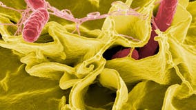 Salmonella: CDC investigating outbreak linked to unknown food source