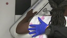 Doctors: Don't delay breast cancer screening due to pandemic