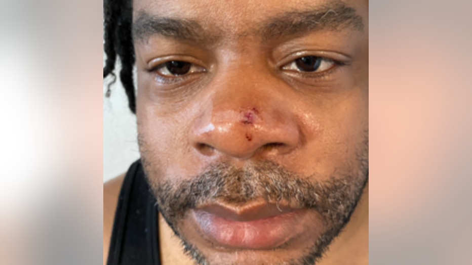 Subway train conductor Trevor Thomas was shot in the face with a BB gun on the No. 2 line. (TWU Local 100)
