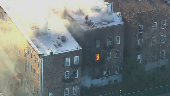 NJ apartment fire leaves 5 hospitalized, 2 are children