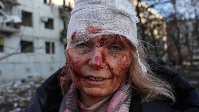 A wounded woman is seen as airstrike damages an apartment complex outside of Kharkiv, Ukraine on February 24, 2022. (Photo by Wolfgang Schwan/Anadolu Agency via Getty Images)