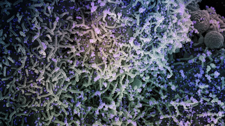 Colorized image of virus particles