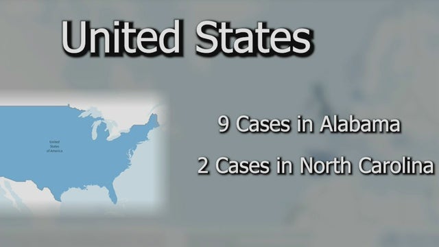 Hepatitis surge among children not a cause for alarm, doctor says