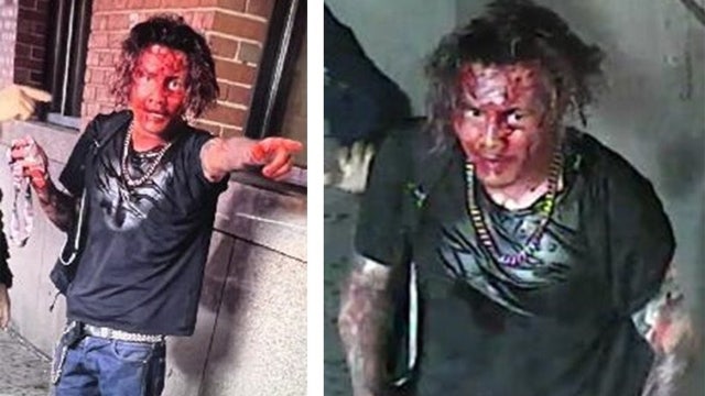 Slasher wanted by NYPD after bloody attack