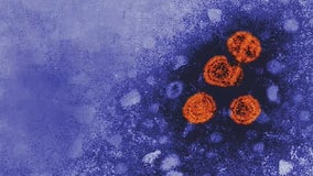 CDC warns of mysterious hepatitis outbreak across U.S.