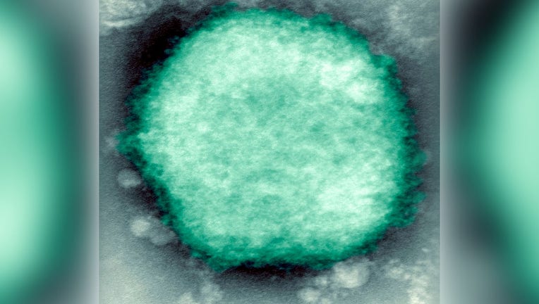 Monkeypox Virus Present In Human Vesicular Fluid. (Photo By BSIP/UIG Via Getty Images)