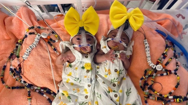 Mom gives birth to identical twins 3 days apart in Texas: 'Very uncommon'