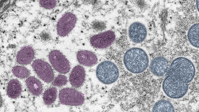 A digitally-colorized electron microscopic (EM) image depicting a monkeypox. 