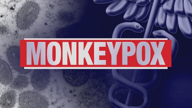 Connecticut reports 1st case of monkeypox