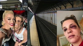 Exclusive: Subway attack victim credits Gwen Stefani for survival