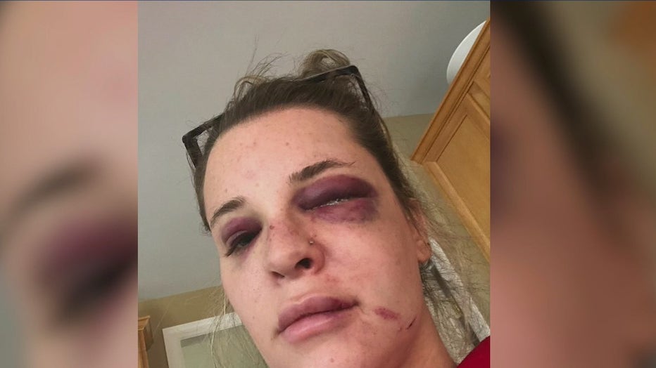 NYC subway shoving victim