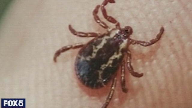 Genes could be key to diagnosing Lyme disease, scientists say