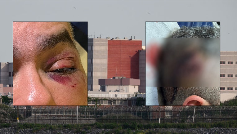 The Correction Officer's union in New York City says it is outraged after a officer was violently assaulted by an inmate on Rikers Island.