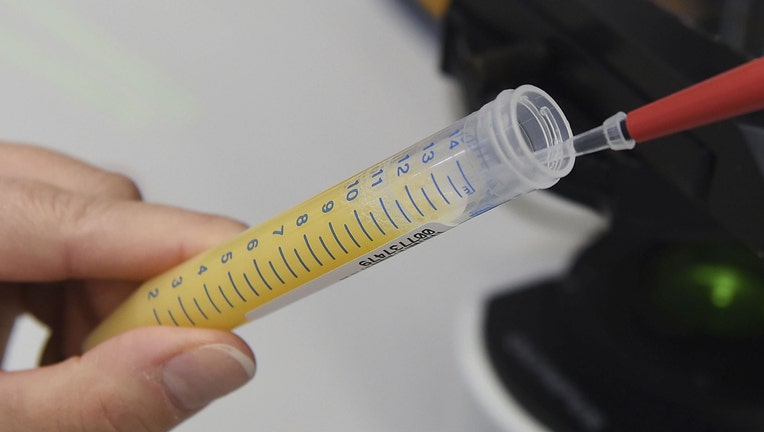 A laboratory worker extracts semen from a test tube. A good breeding bull can have up to 100,000 descendants. (Photo by Carmen Jaspersen/picture alliance via Getty Images)