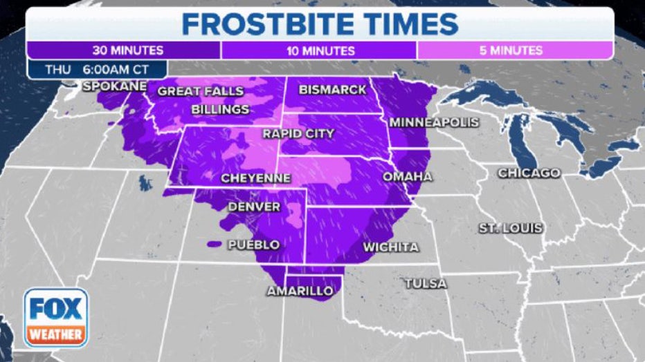 FOX-Weather-frostbite-times.jpg
