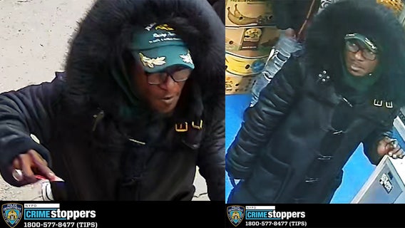 Man stabbed multiple times in the head in the Bronx